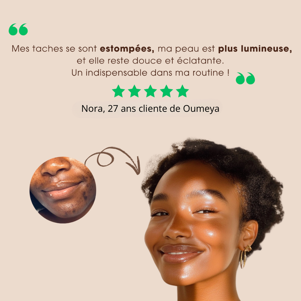 Oumeya-Savon Anti-Taches au Curcuma et à l’Acide Kojique