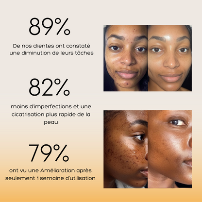 Oumeya-Savon Noir Anti-Imperfections