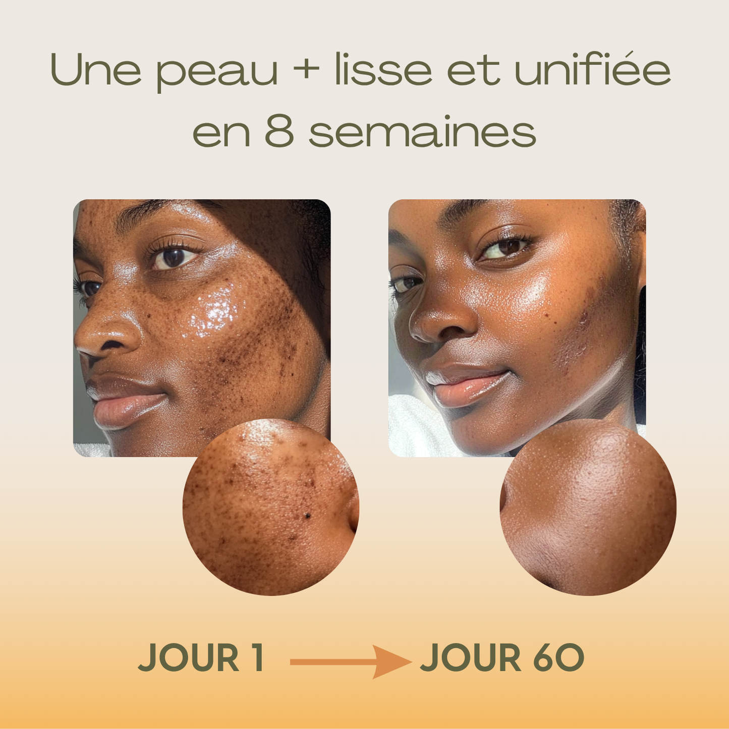 Oumeya-Savon Anti-Taches au Curcuma et à l’Acide Kojique