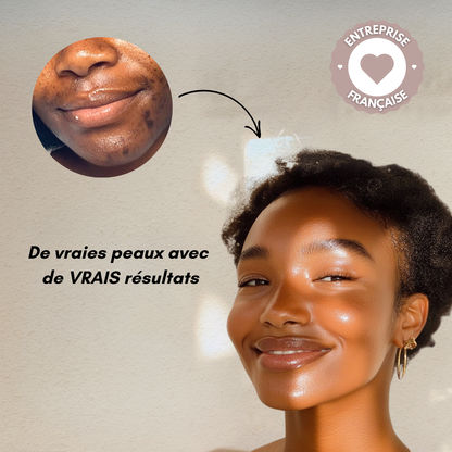 Oumeya-Savon Noir Anti-Imperfections